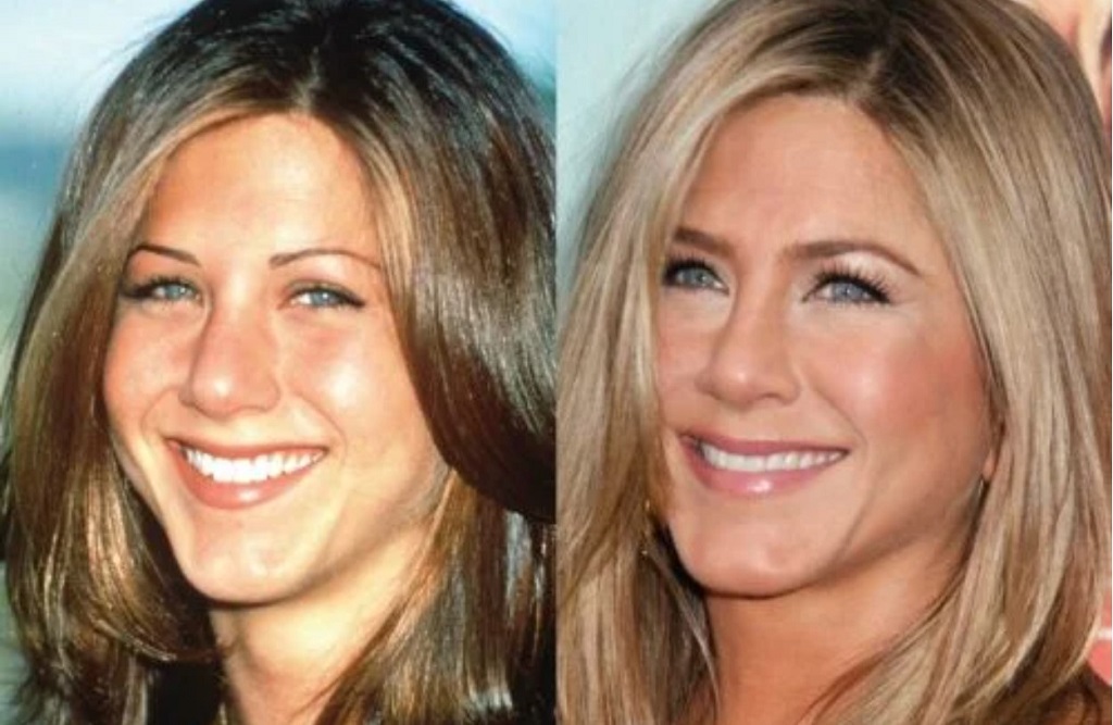 Jennifer Aniston Nose Job 