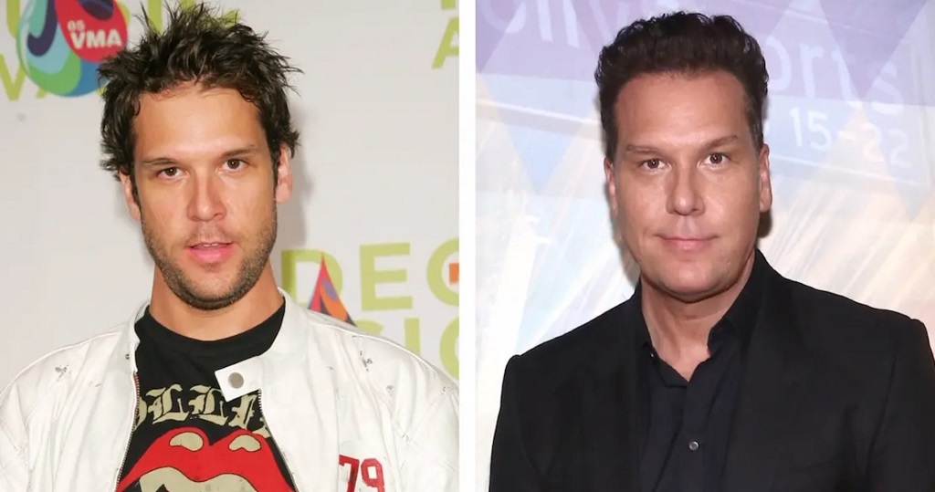 Dane Cook Facelift