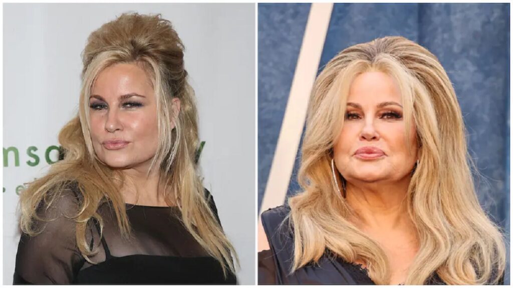 Jennifer Coolidge Plastic Surgery