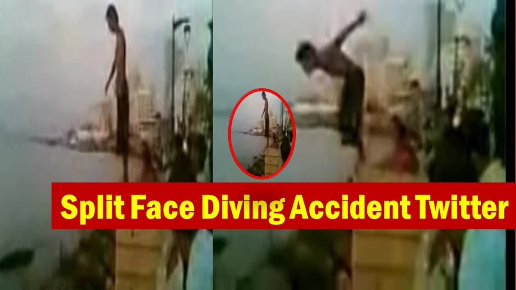 Face Split Diving Accident