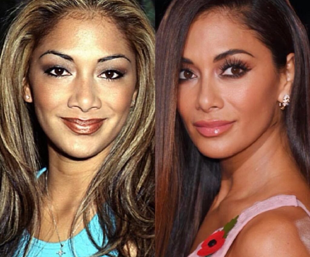 Nicole Scherzinger Nose Job