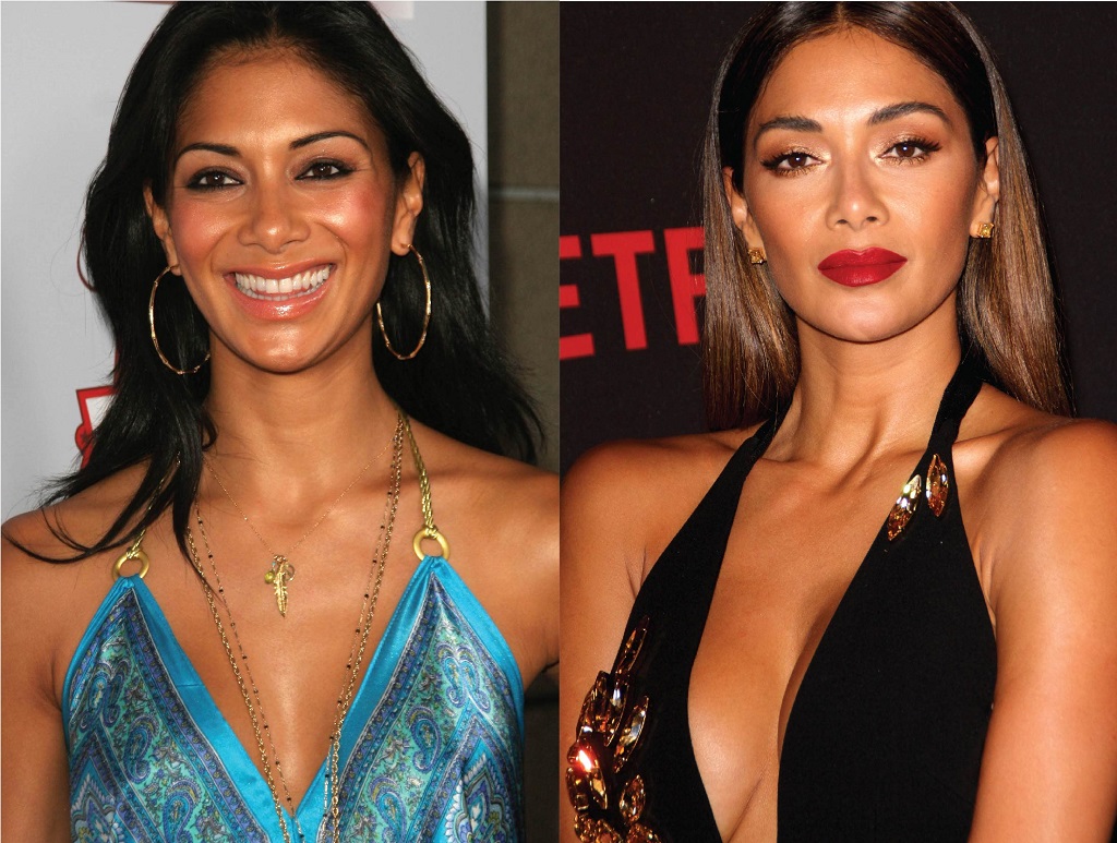 Nicole Scherzinger Nose Job