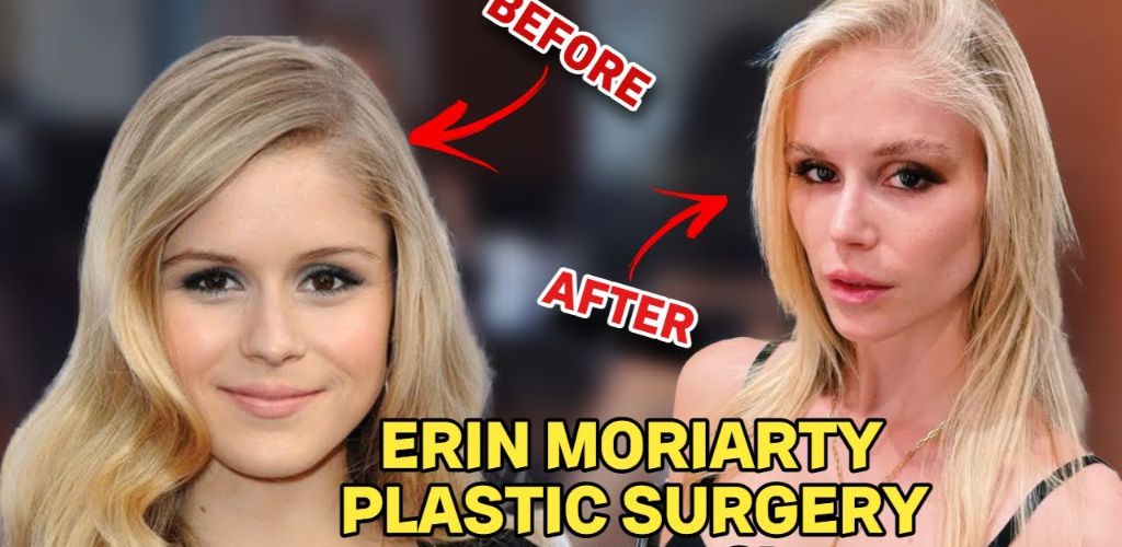 Erin Moriarty Nose Job