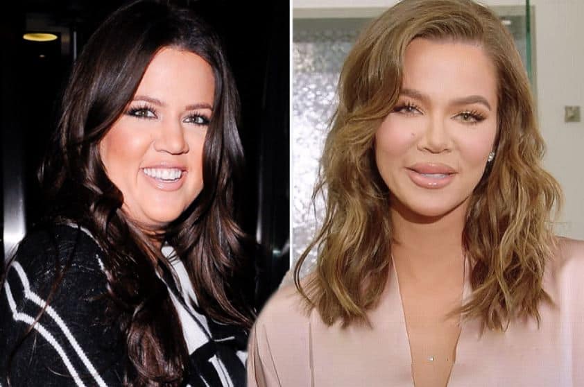 Khloe Kardashian Before and After