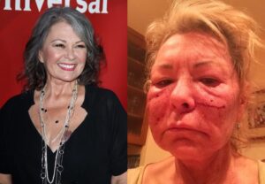 Roseanne Barr Before and After Plastic Surgery Pics - Career