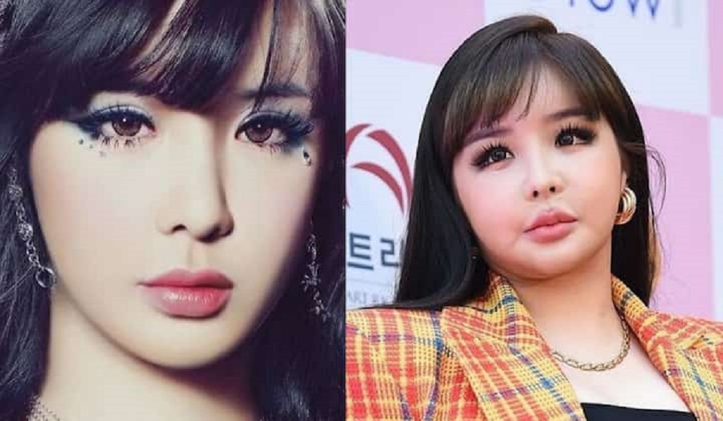 Park Bom before and after plastic surgery