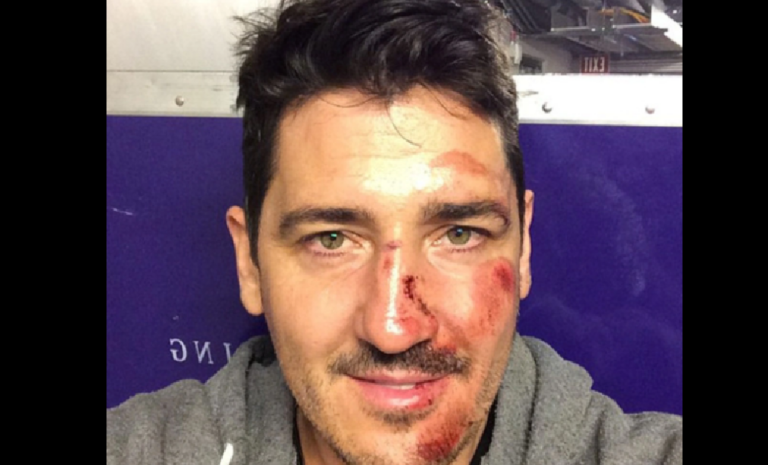Jonathan Knight Accident – What Happened To Him? Injury Health And Family
