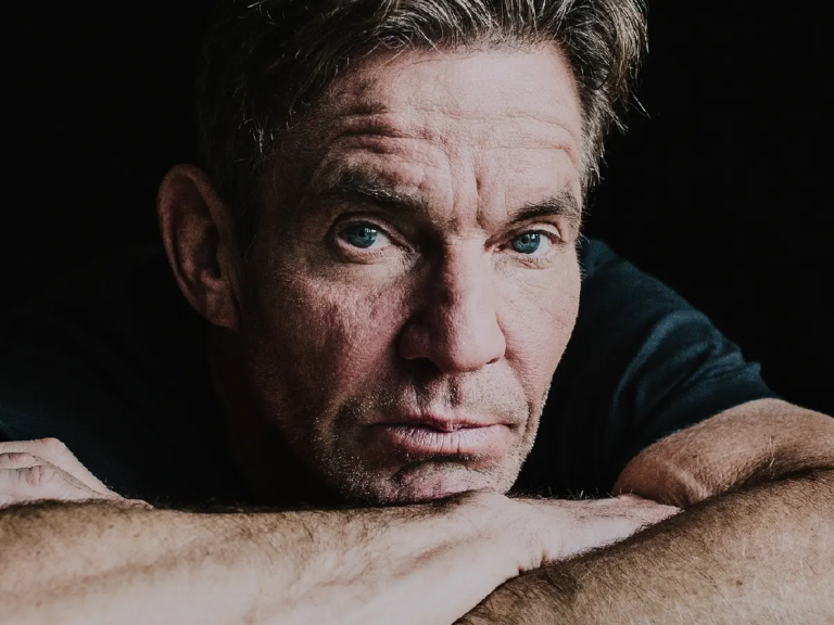 Dennis Quaid Plastic Surgery, Before After Pics - Age