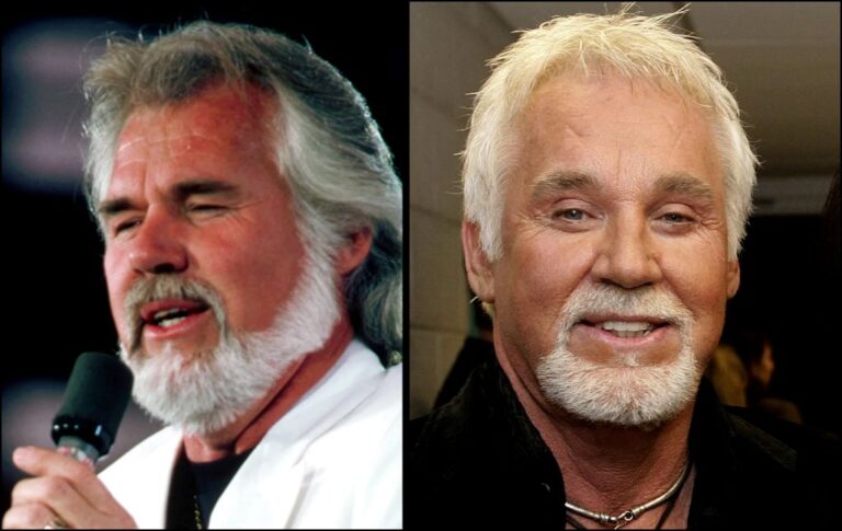 Kenny Rogers Botox And Nose Job - Before And After Surgery