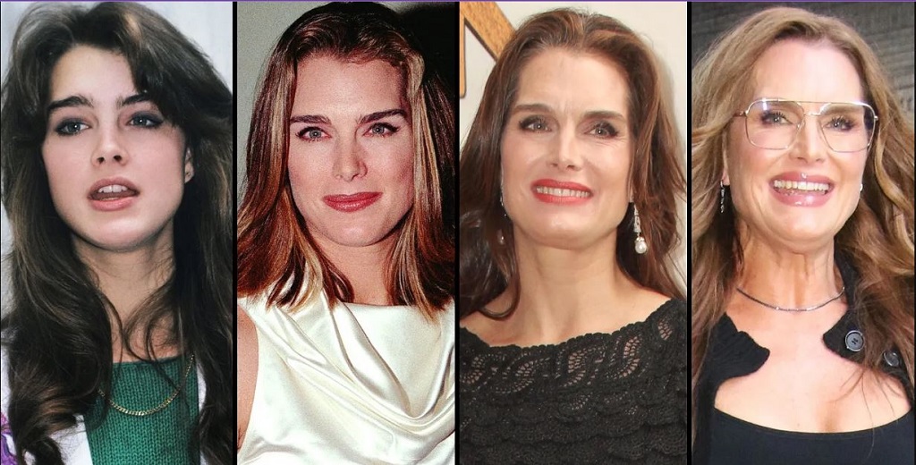 Brooke Shields Hair - Natural or Wig Nose Job Transformation