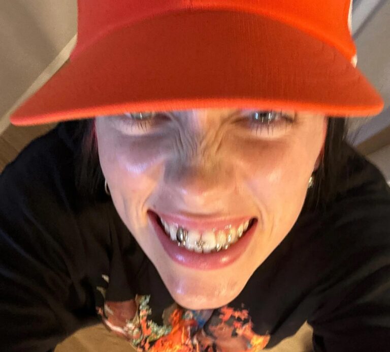 Is Billie Eilish Missing A Tooth: What Happened?